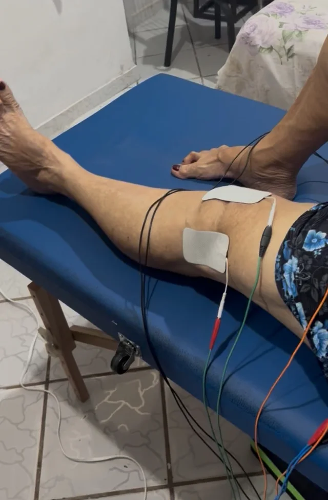 Eletrodos posicionados na região do joelho durante atendimento.